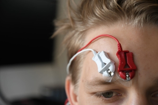 Facial EMG measurement in action: a person with electrodes attached to their brow muscles.